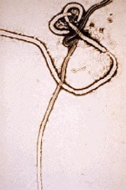 伊波拉病毒。电子显微照片由c提供