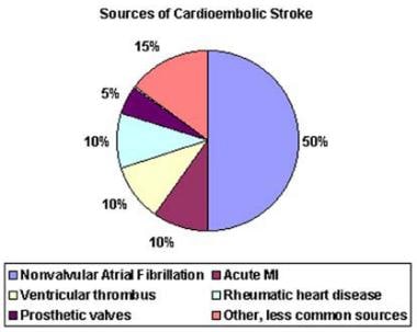 Ischemic Stroke Revealing Infective Endocarditis in a Young Subject: About  a Clinical Case