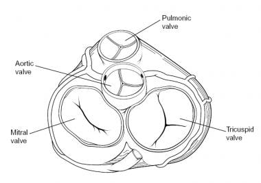 Pulmonic Valve Anatomy Overview Pathophysiologic Variants