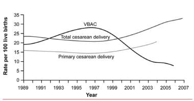 Vaginal birth after cesarean delivery rates. 