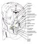 Vertebrobasilar Stroke
