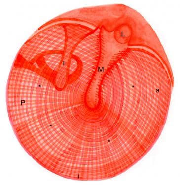 Drawing of a normal right tympanic membrane. Note 