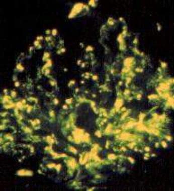 Immunofluorescence (X25): Fine granular deposits o