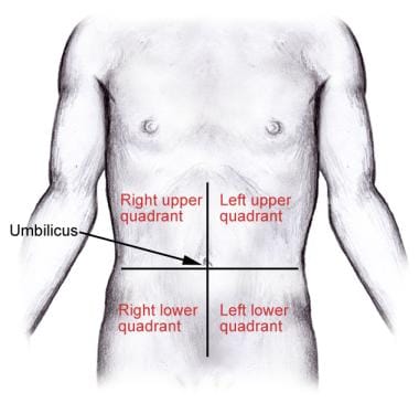 A bulge was observed on the left femoral area below the groin