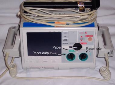 Transcutaneous Cardiac Pacing. A defibrillator wit
