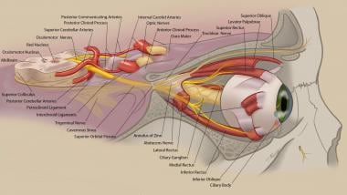 Anatomy of the oculomotor nerve. Courtesy of Tyler