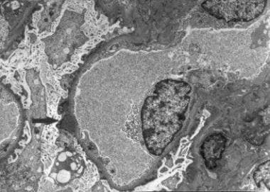 Ultrastructure (electron microscopy): Photograph s