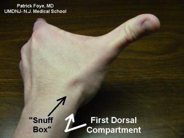 The first dorsal compartment of the wrist includes