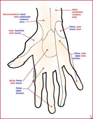 Soft Tissue Injuries of the Hand: Practice Essentials, Pathophysiology