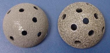 Metallic alloys. Tantalum (left) and titanium (rig