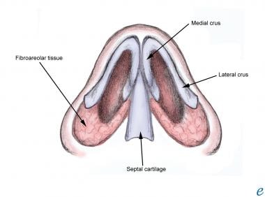 nazal septal hematom