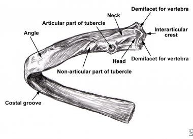 Rib Fracture Imaging: Overview, Radiography, Computed Tomography