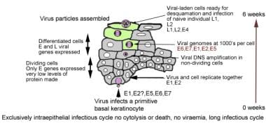 condyloma acuminatum excision cpt code