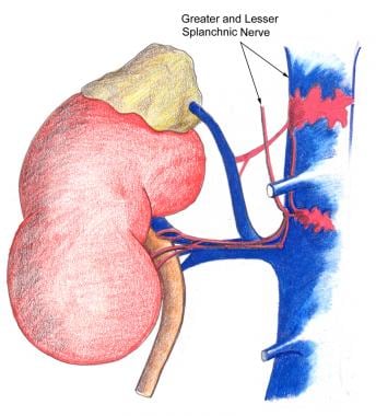 Nephrolithiasis: acute renal colic. Nerve supply o