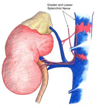 Flank Pain/Renal Colic