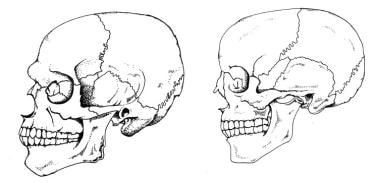 男性(左)和女性(左)头骨的侧面视图