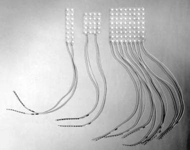 Examples of various grid electrodes available for 