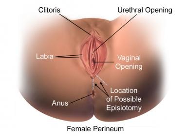 Episiotomy and Repair Background Indications Contraindications