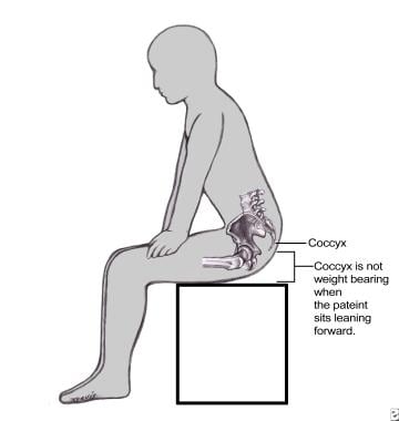 Patients with a painful coccyx often find it more 