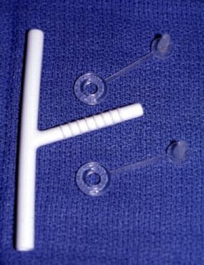 A 7-mm Montgomery tracheotomy tube with caps 