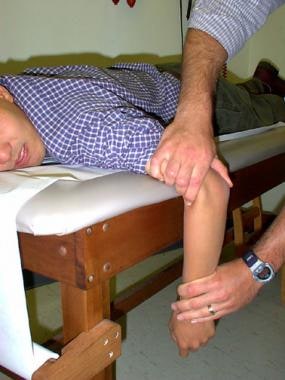 The preferred method for posterior elbow dislocati