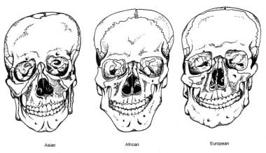 Anterior views of skulls depicting ancestry skelet
