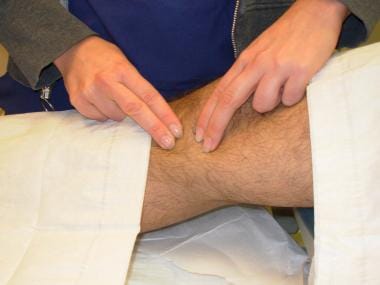 Identify the landmarks: medial femoral and tibial 