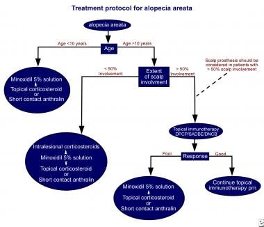 alopecia areata treatment injection