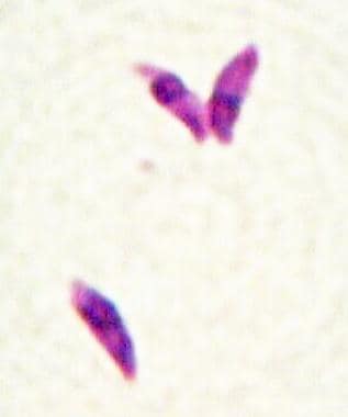 Toxoplasma gondii tachyzoites (Giemsa stain). 