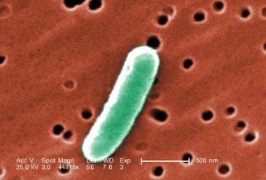 Gram-negative Escherichia coli. 