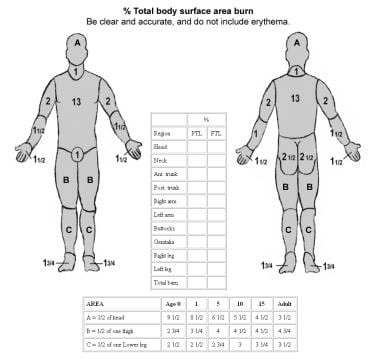 Burn Classification Chart