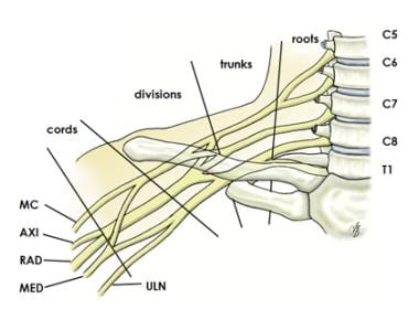 Brachial plexus with terminal branches labeled. MC