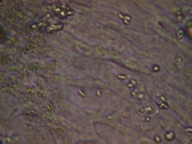 Toxoplasma gondii tachyzoites in cell line. 