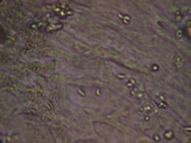 Emberi toxoplazma. User Top Links