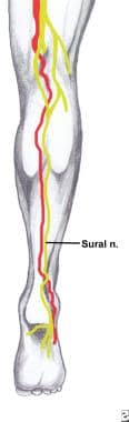 腓肠神经位于隐静脉外侧