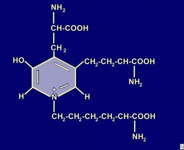 Deoxypyridinoline. 