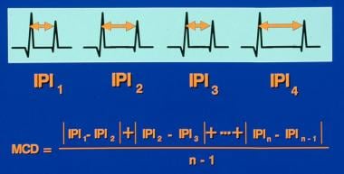 Single-fiber electromyography. Calculation of the 
