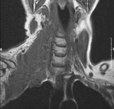 Sagittal magnetic resonance imaging (MRI) section 