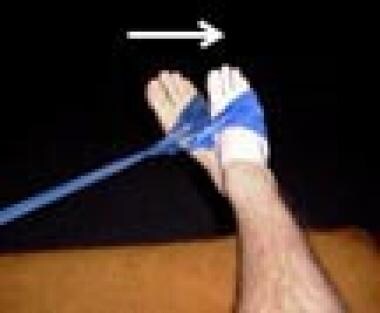 Ankle Sprain - Rehab Science