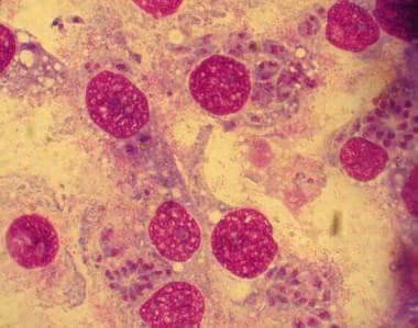 Toxoplasma gondii in infected monolayers of HeLa c