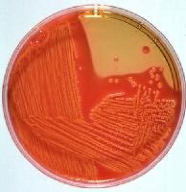Hektoen enteric agar with Escherichia coli colonie