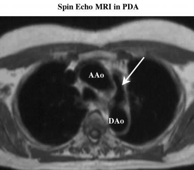 Axial electrocardiograph-gated, spin-echo magnetic