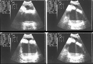 Sonograms from a 42-year-old man who presented wit