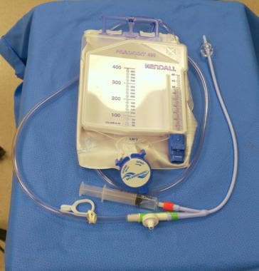 Urinary catheter urine collection bag. Image court