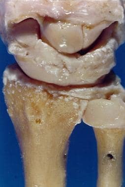 Triangular fibrocartilage complex provides continu
