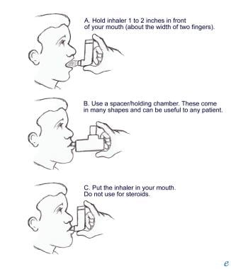 Use Of Metered Dose Inhalers, Spacers, And Nebulizers: Practice ...