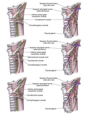 Superior laryngeal nerve (SLN). 