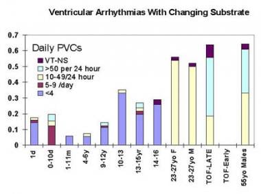 Ventricular arrhythmias with changing substrate. T