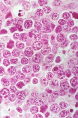 Hematoxylin and eosin (H&E) stain. Sheets of monot