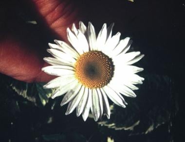 Daisy flower, Leucanthemum species, with character